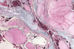 A microscopic view of human tissue with cell structure Product Image 1