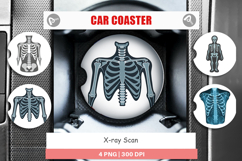 Car Coaster X-Ray Scan Product Image 1