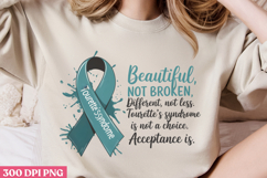 Beautiful Not Broken PNG, Syndrome Sublimation PNG Product Image 2