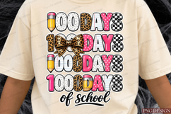 100 Days of School Sublimation Design Product Image 3