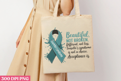 Beautiful Not Broken PNG, Syndrome Sublimation PNG Product Image 1