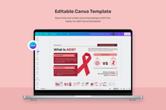 Medical Education Disease Infographic Product Image 3