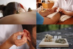 Acupuncture session x16 Pack Product Image 2