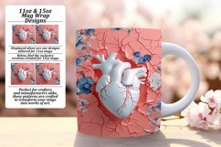 Valentine's Day Mug Art - 11oz &amp; 15oz Elegance Product Image 1