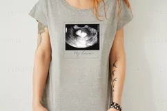 Sublimation PNG Ultrasound Photos Product Image 4