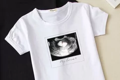 Sublimation PNG Ultrasound Photos Product Image 3