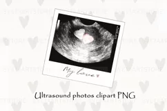 Sublimation PNG Ultrasound Photos Product Image 1