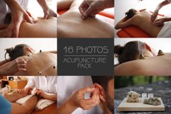 Acupuncture session x16 Pack Product Image 1