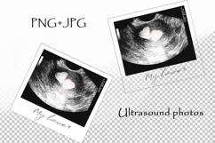 Sublimation PNG Ultrasound Photos Product Image 2
