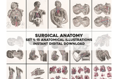 Vintage Surgical Anatomy Illustrations Images Bundle Set 1 Product Image 1