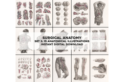 Vintage Surgical Anatomy Illustrations Images Bundle Set 2 Product Image 1