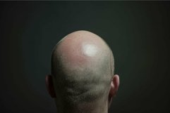 Shaved head of a man standing in the dark Product Image 1