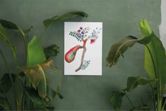 Watercolor Human cholecyst and hepatic duct, gallbladder. Product Image 4