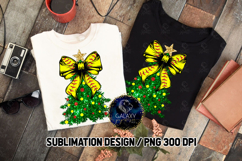 Softball Coquette Christmas Tree Glitter Sublimation Product Image 1