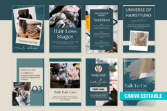 Hair Loss Canva Social Media Bundle, Hair Loss Treatment Product Image 11