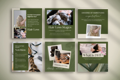 Hair Loss Canva Social Media Bundle, Hair Loss Treatment Product Image 9