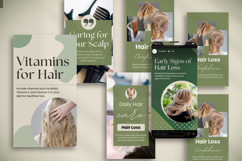 Hair Loss Canva Social Media Bundle, Hair Loss Treatment Product Image 4