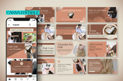 Hair Loss Canva Social Media Bundle, Hair Loss Treatment Product Image 3