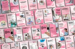 Healthcare Instagram Story Templates Product Image 4