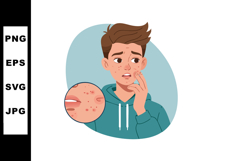 Teenager worried about acne skin problem with closeup of red Product Image 1