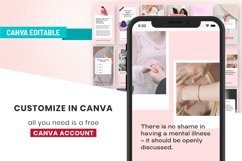 Mental Health Instagram Canva Story Template Product Image 3