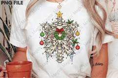 Radiology Christmas Ribcage Product Image 2
