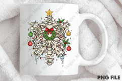 Radiology Christmas Ribcage Product Image 4