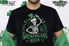 Let The Shenanigans Begin PNG Skeleton St Patrick's Day DTF