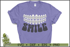 Smile Braces SVG File Product Image 1