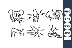 Painful Joint Bone Inflammation Vector Art Product Image 1