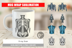 Mug Wrap X-Ray Scan Product Image 1