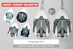 Earring X-Ray Scan Product Image 1