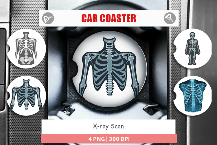 Xray Clipart