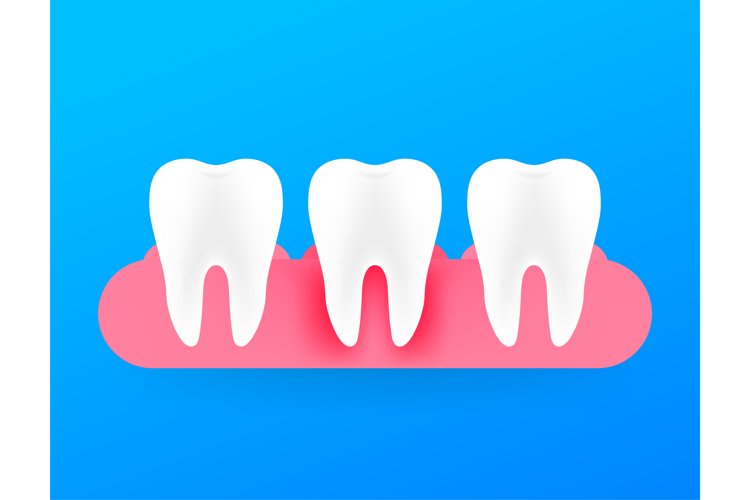 Gum disease, periodontitis. Healthy white tooth. Vector stoc example image 1