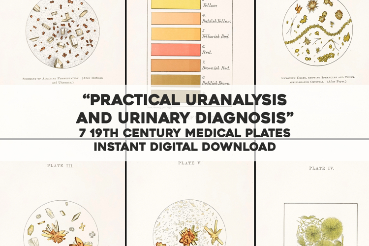 7 Vintage Medical Plates from 19th Century Urinalysis Book