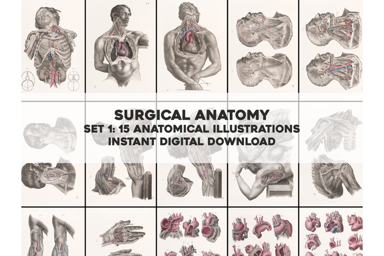 Vintage Surgical Anatomy Illustrations Images Bundle Set 1