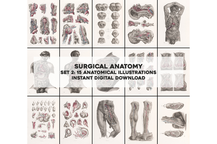 Vintage Surgical Anatomy Illustrations Images Bundle Set 2