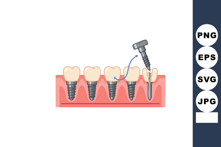 Dental Clipart Image 3