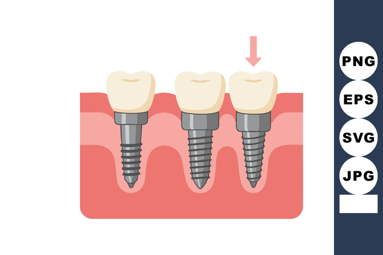 Teeth Clipart Image 21