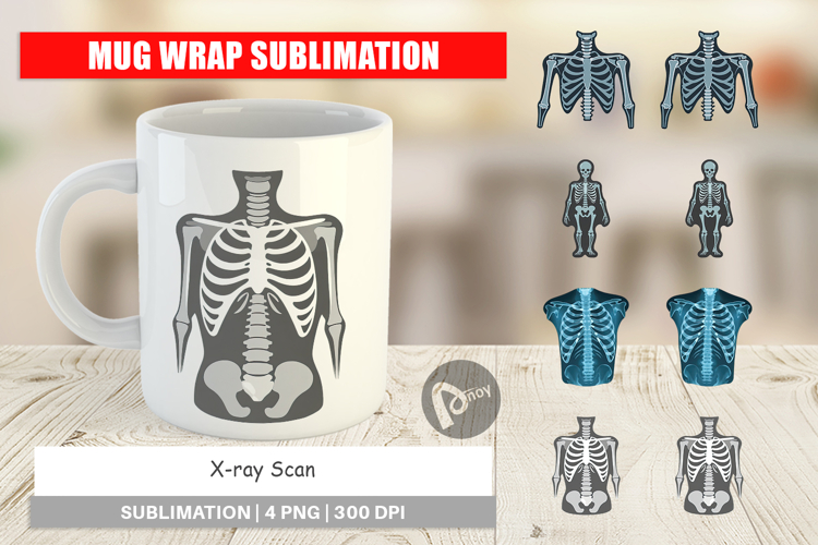 Xray Clipart Image 13