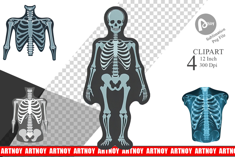 Xray Clipart Image 12