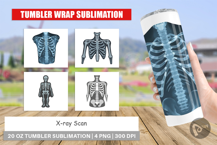 Xray Clipart Image 9