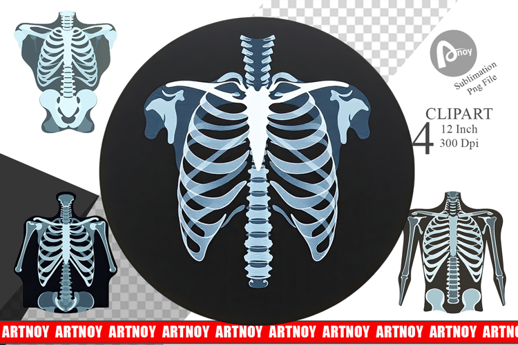 Xray Clipart Image 11