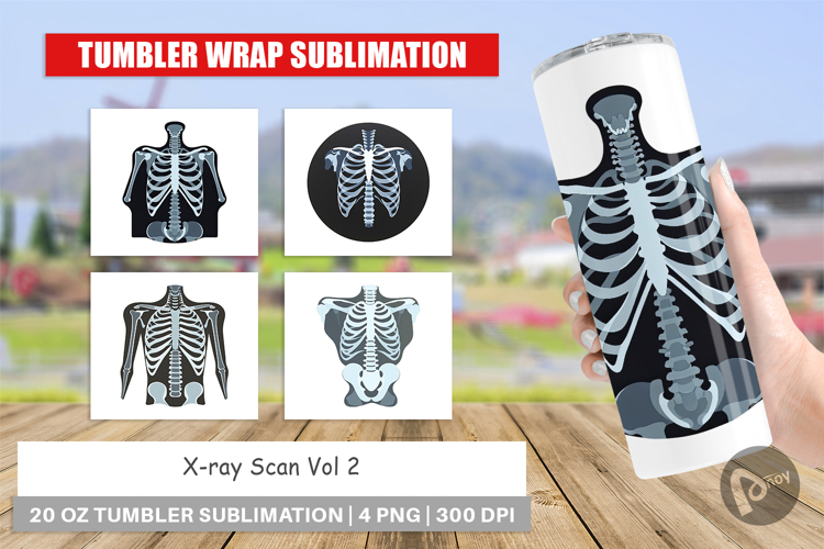 Xray Clipart Image 8