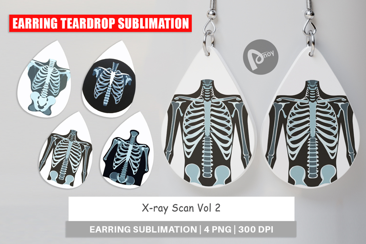 Xray Clipart Image 20