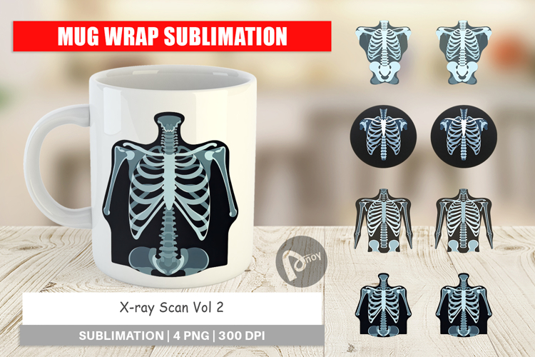 Xray Clipart Image 12
