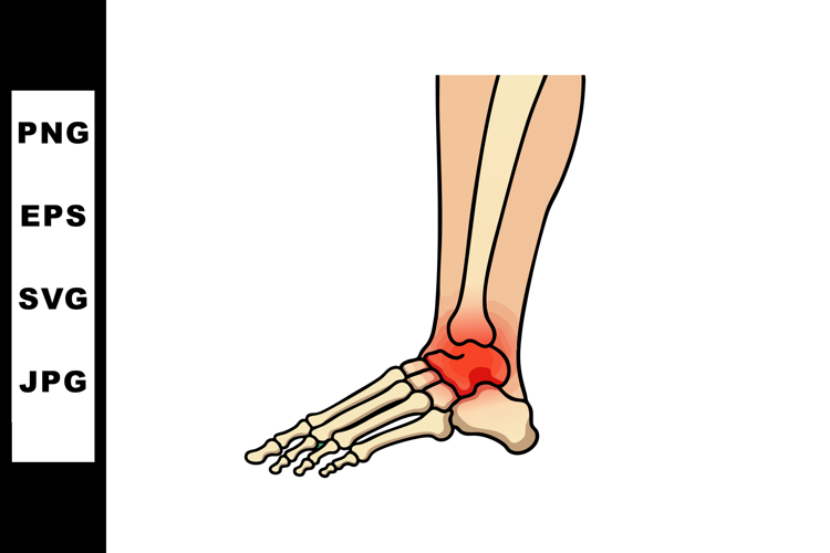 Joint Clipart Image 11